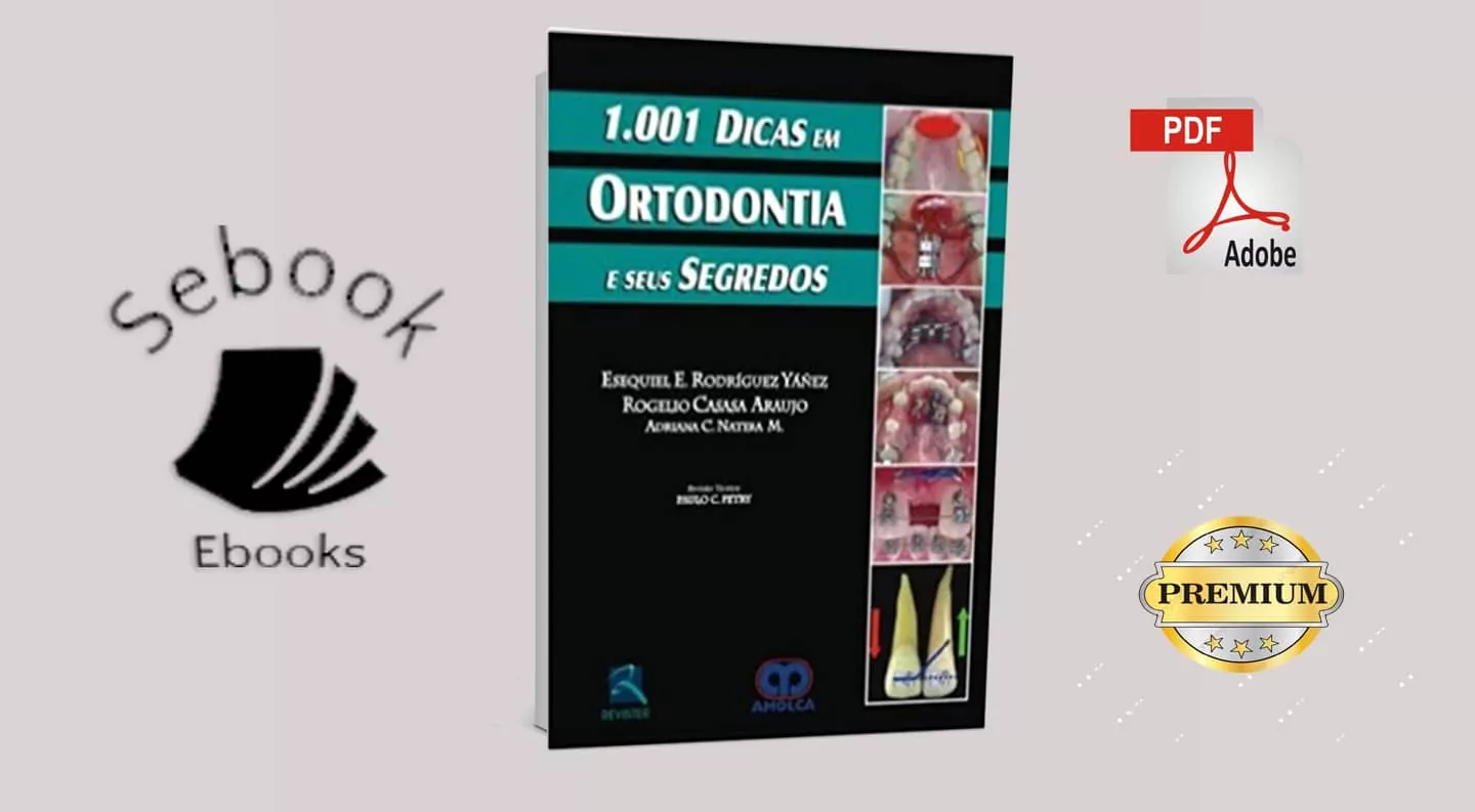 147574Ebook: 1001 dicas em ortodontia e seus segredos – PDF